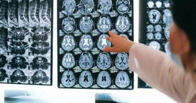 دراسة تكشف تأثير كورونا "المرعب" على المخ والذاكرة