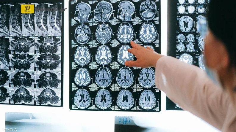 دراسة تكشف تأثير كورونا “المرعب” على المخ والذاكرة