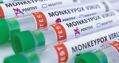 منظمة الصحة العالمية تعقد اجتماعات لتحديد ما إذا كان جدرى القرود يمثل حالة طارئة عالمية