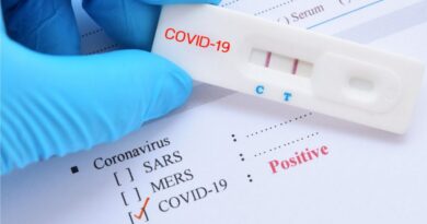 كوفيد-19 يعاود الانتشار في اليونان: واتحاد أطباء المستشفيات يحثون على ارتداء الأقنعة في المستشفيات